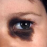 Teaser Diagnose Quizz