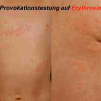 Screenshot Kinderdermatologie