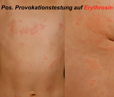 Screenshot Pädiatrische Dermatologie
