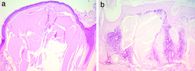 eosinophiles, amorphes Material, Epidermis, Adnexstrukturen