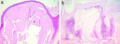 eosinophiles, amorphes Material, Epidermis, Adnexstrukturen