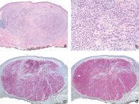 Übersichtsaufnahme Läsion, Tumor