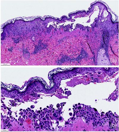 Bild Histopathologie Hämatoxylin-Eosin-Färbung