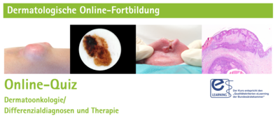 Banner CME-Kurs für Hautaerzte