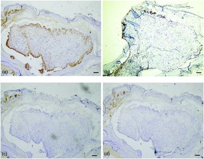 Foto immunhistochemischen Ergebnisse positive und negative Expression