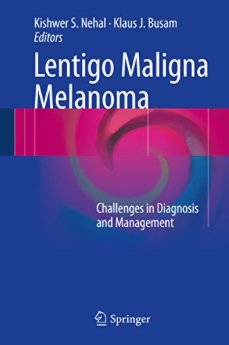 Cover Lentigo Maligna Melanoma