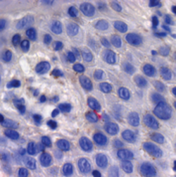 Histologie, Infiltration von Plasmazellen, immunhistochemische Färbung