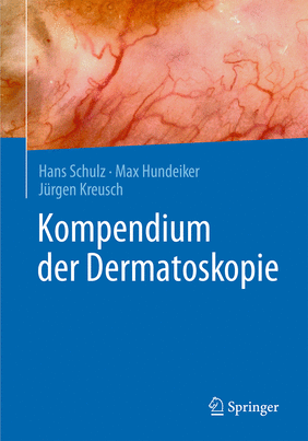 Cover Cover Dermatoskopie
